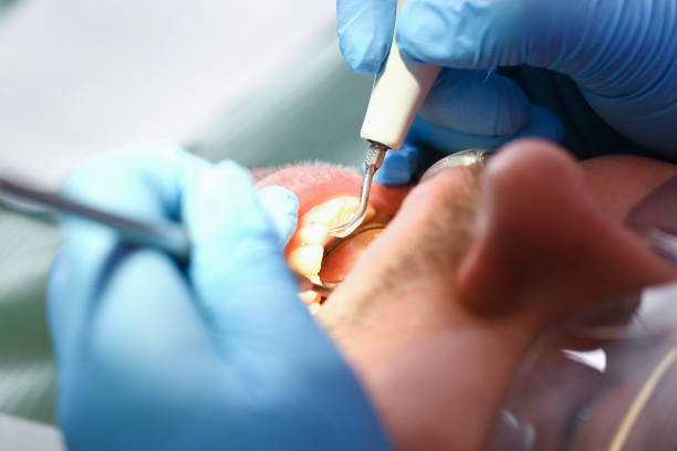 Best Mobile Emergency Dentist in Del Monte Forest, CA