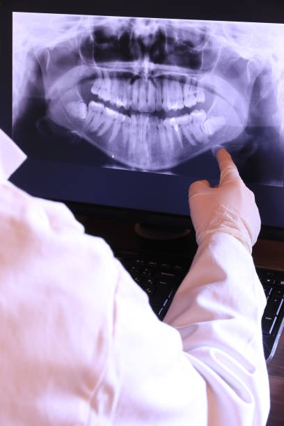 Best Urgent Dental Care for Toothache in Del Monte Forest, CA