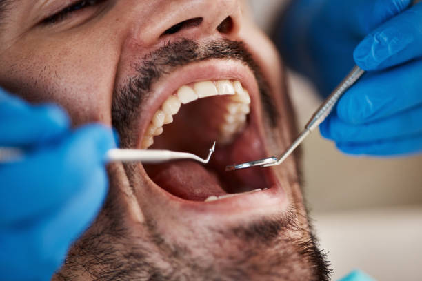 Best Emergency Dentist for Knocked-Out Tooth in Del Monte Forest, CA